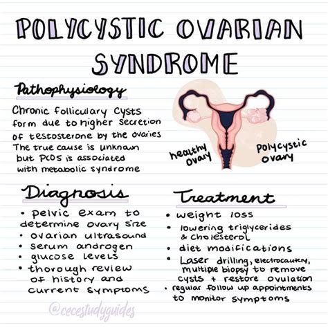 pcos gpnotebook.